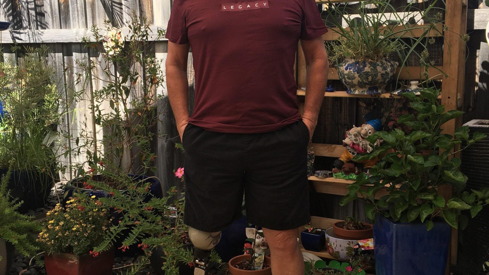 Robert, aged 67, stands in his garden in shorts with his prosthetic leg visible.